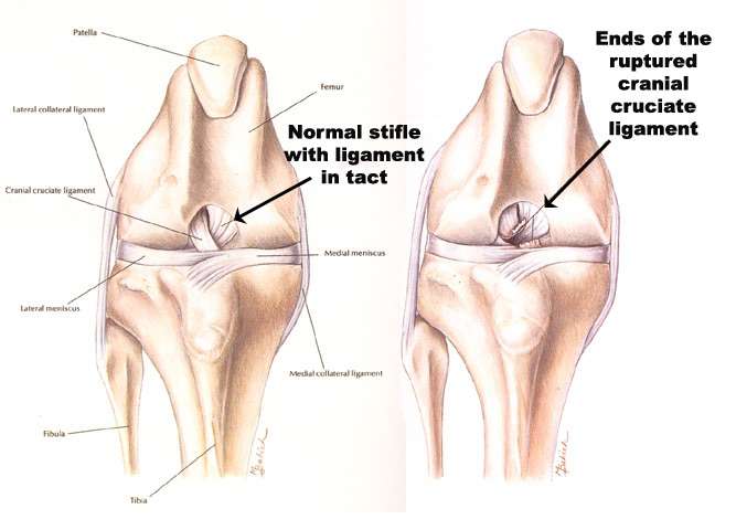 infographic of acl